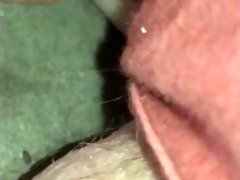 Popping huge pussy cyst